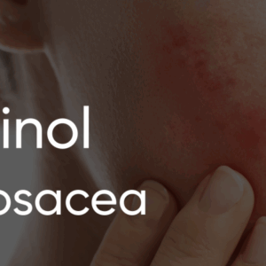 Retin-A and Rosacea treatment cream.