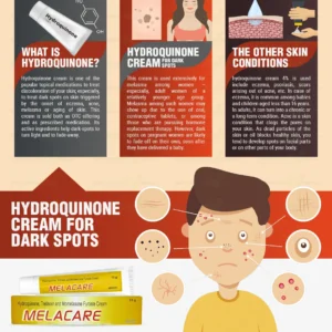 Spot treatment with hydroquinone. Dark-spot correcting cream.