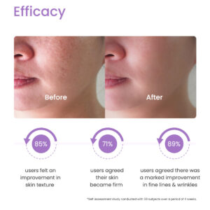 Retin-A for skin: Cream or gel tube.