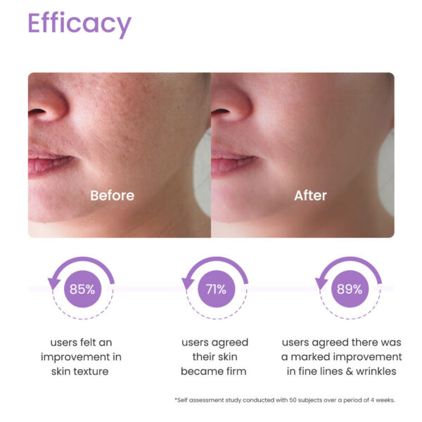 Retin-A for skin: Cream or gel tube.
