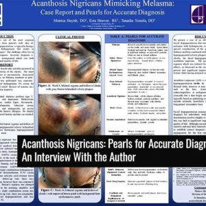 Tretinoin cream for acanthosis nigricans treatment.