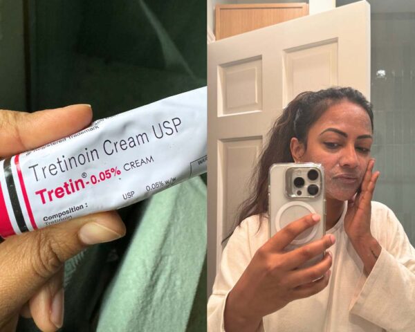 Tretinoin 0.01% gel before & after results.