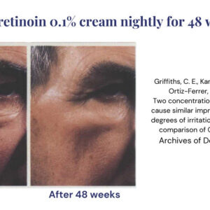 Before & after photos showcasing Retinol Tretinoin results.
