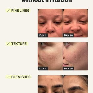 Retinol 0.01% Gel, skincare product
