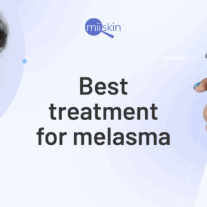 Tretinoin cream for melasma treatment.