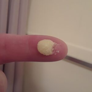 Tretinoin Microsphere Gel 0.1% by Janssen.