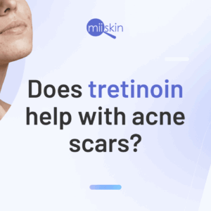 Tretinoin gel for scar treatment.