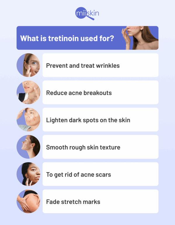 Tretinoin cream for burn scar treatment.