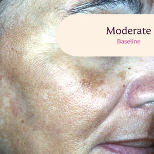 Tri Luma Uses brightening skincare product.